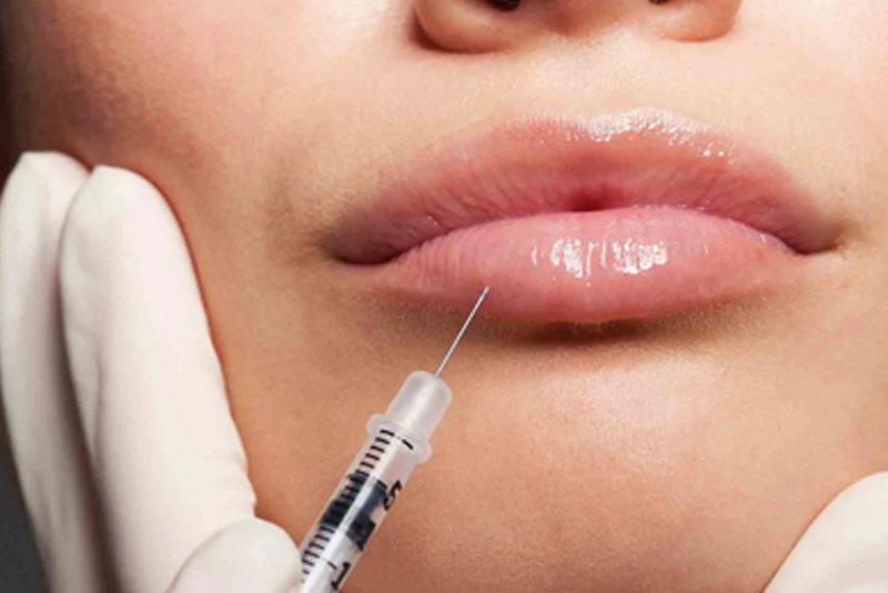 Imagem do fornecedor