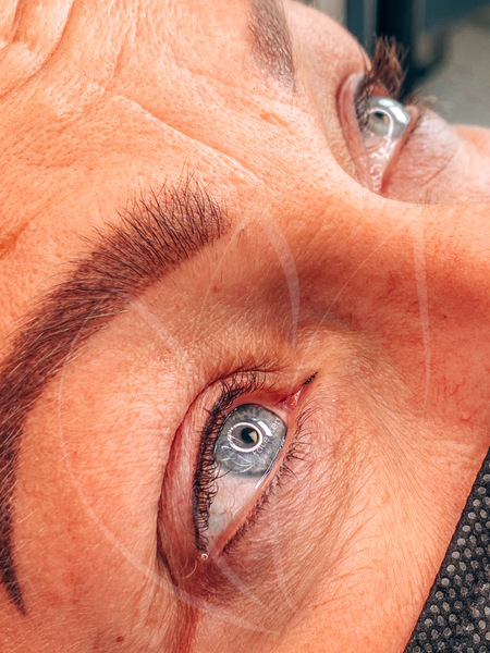 Wimpernkranzverdichtung oben und leichte Pigmentierung unten