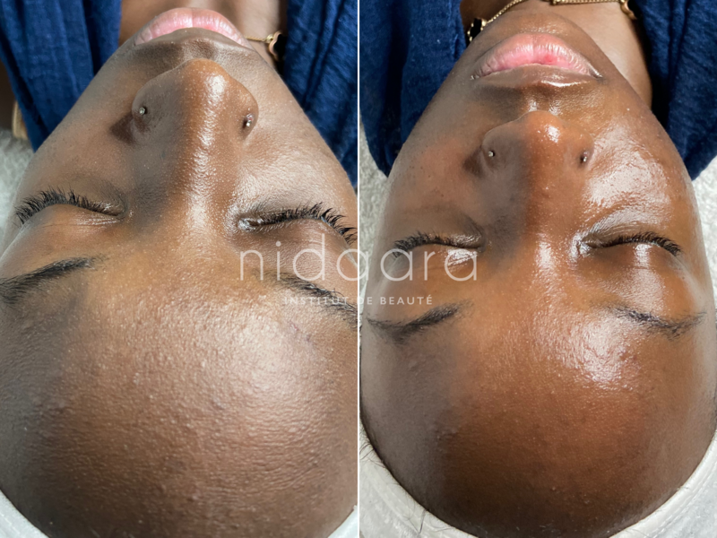 Après le soin Hydratant & Apaisant